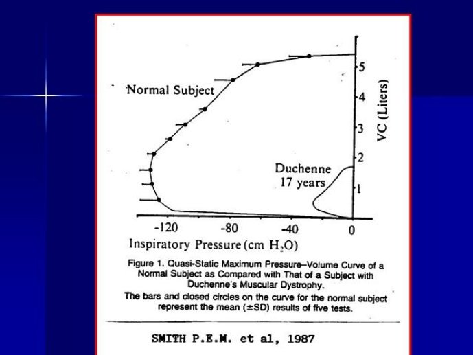 Diapositive17