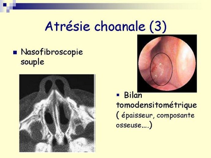 Diapositive10