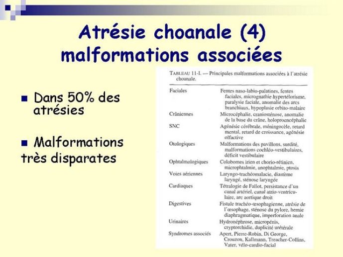 Diapositive11