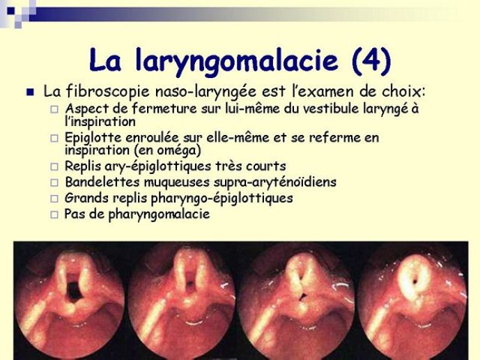 Diapositive38