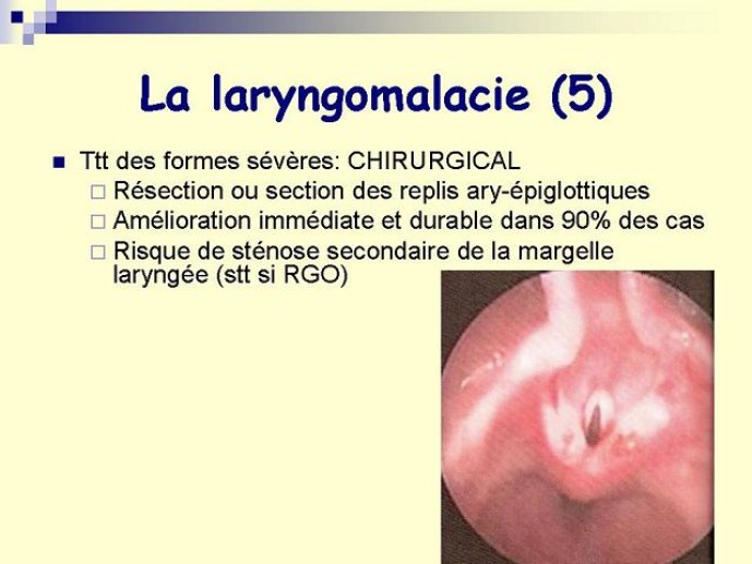 Diapositive39