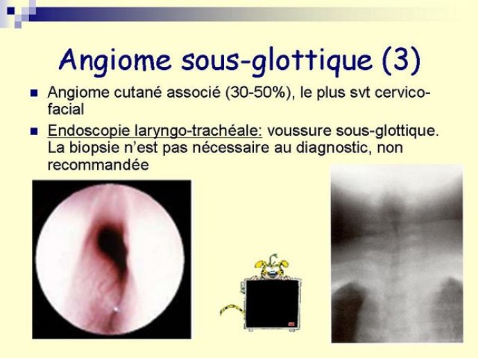 Diapositive51