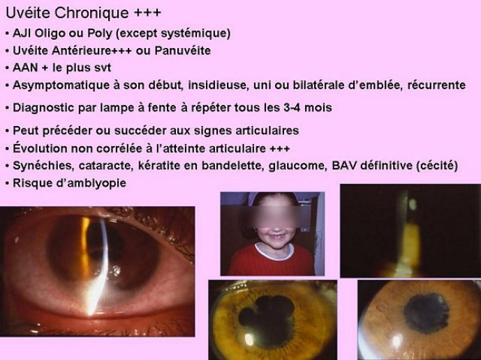Diapositive23