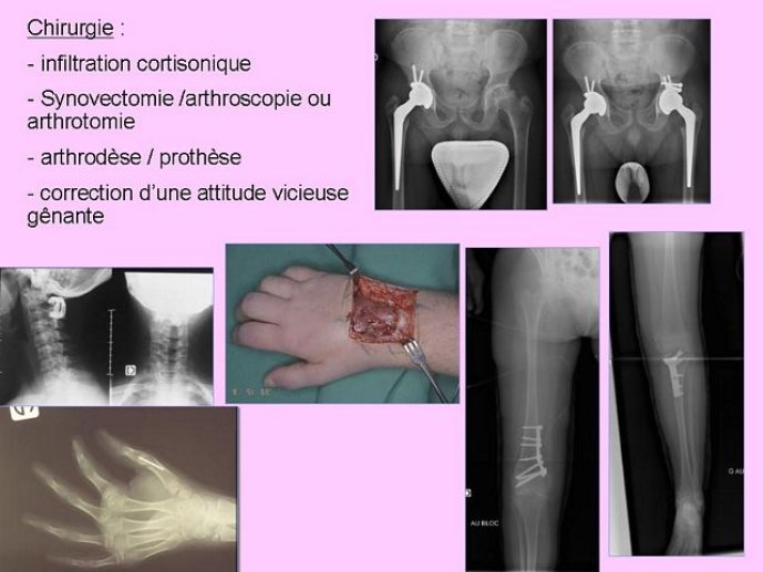 Diapositive39