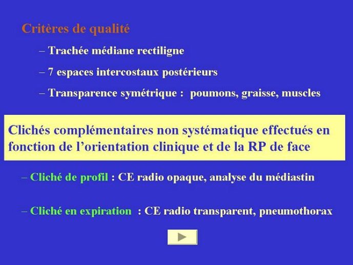 Diapositive6