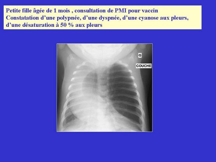 Diapositive36