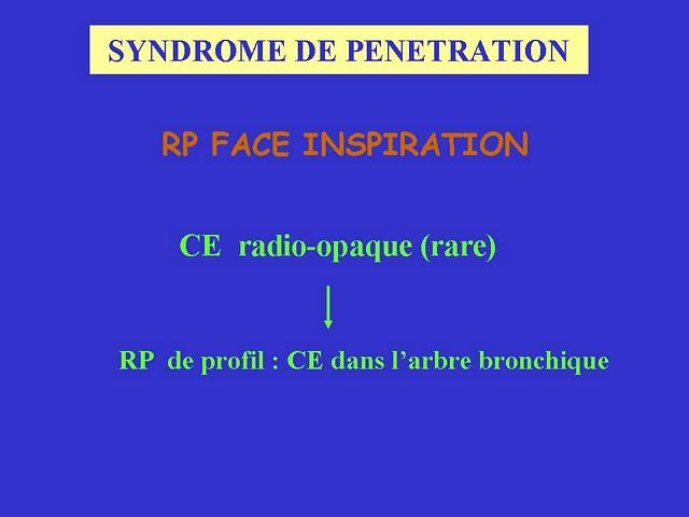 Diapositive45