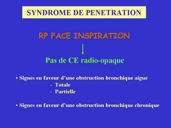 Diapositive49