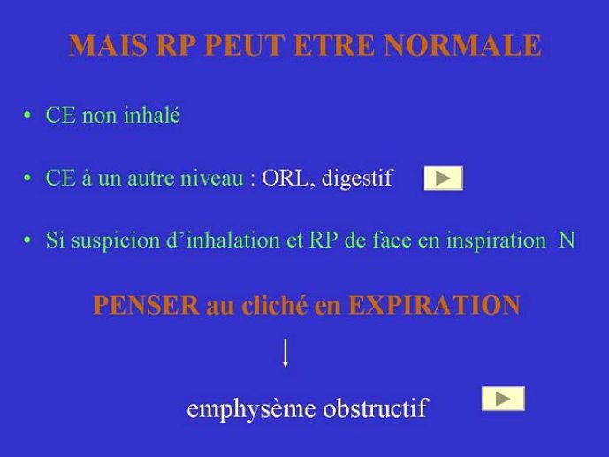 Diapositive52