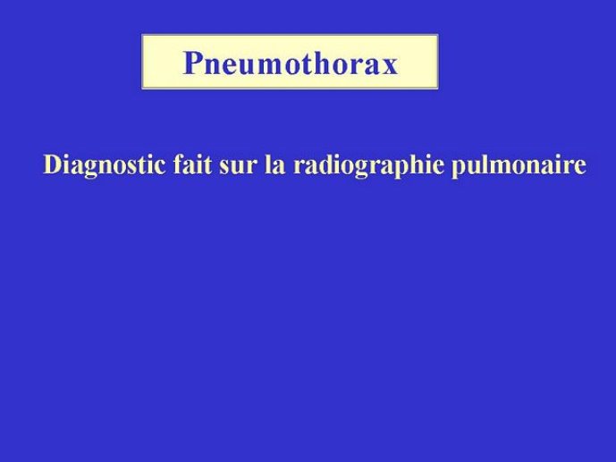 Diapositive55