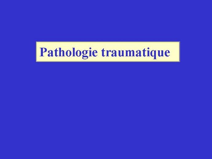 Diapositive62