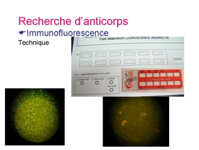Barbeyrac11