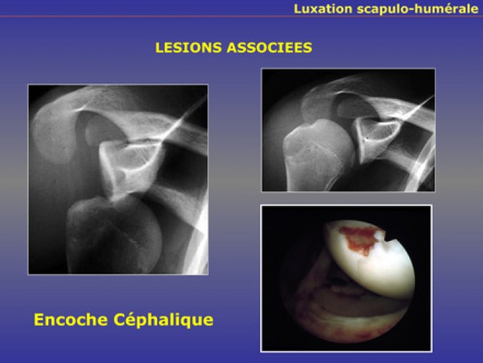 LeHuec18
