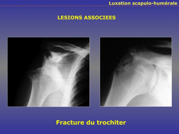LeHuec19