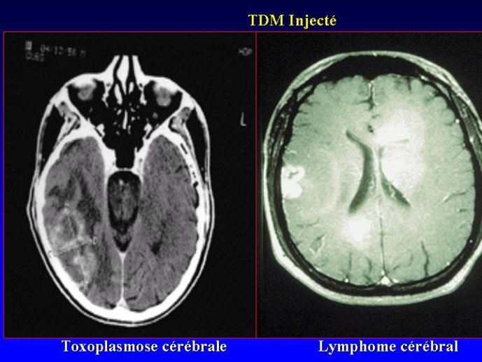 Diapositive15