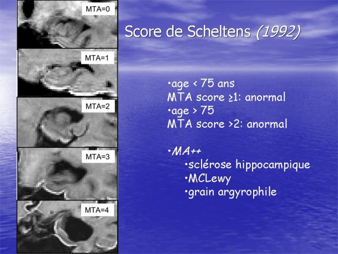 Diapositive43