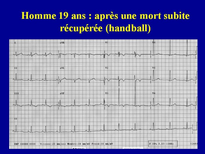 diapositive5