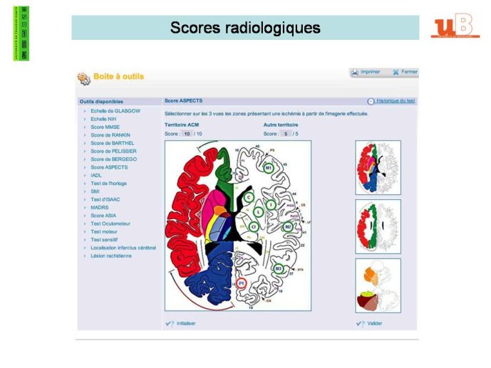 diapositive36