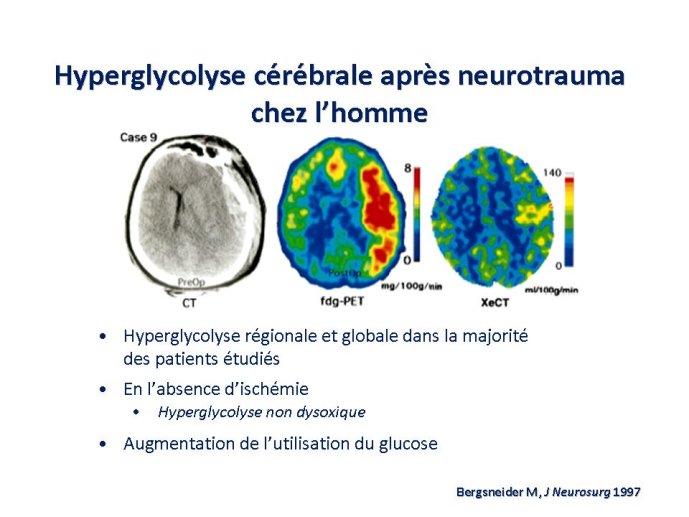 diapositive15