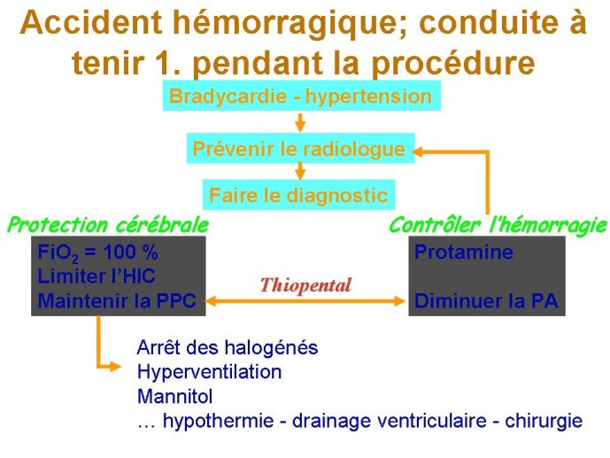 diapositive9