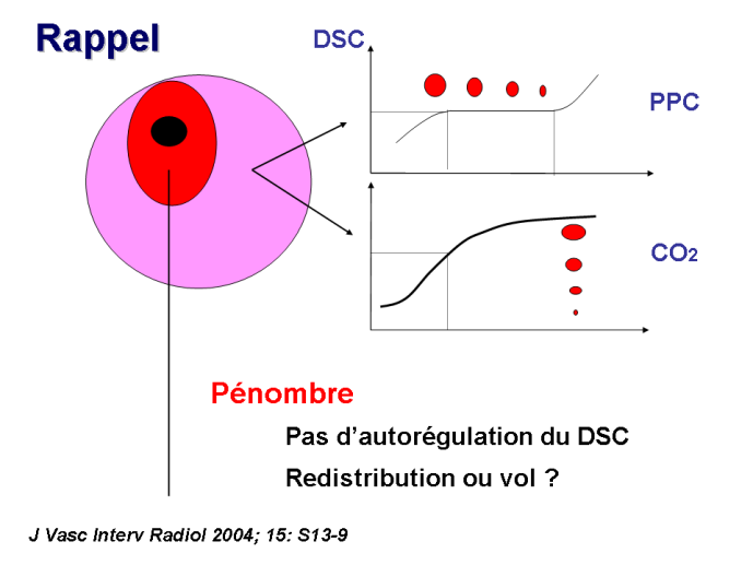 diapositive11