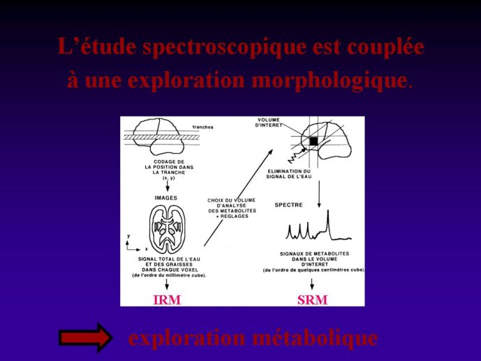 diapositive25