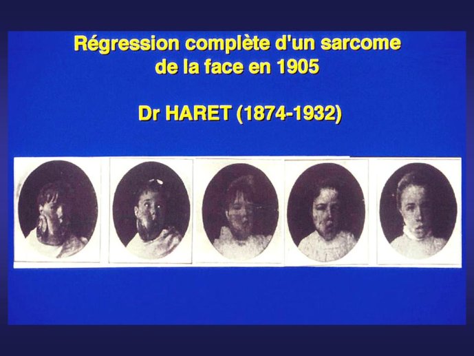 diapositive15
