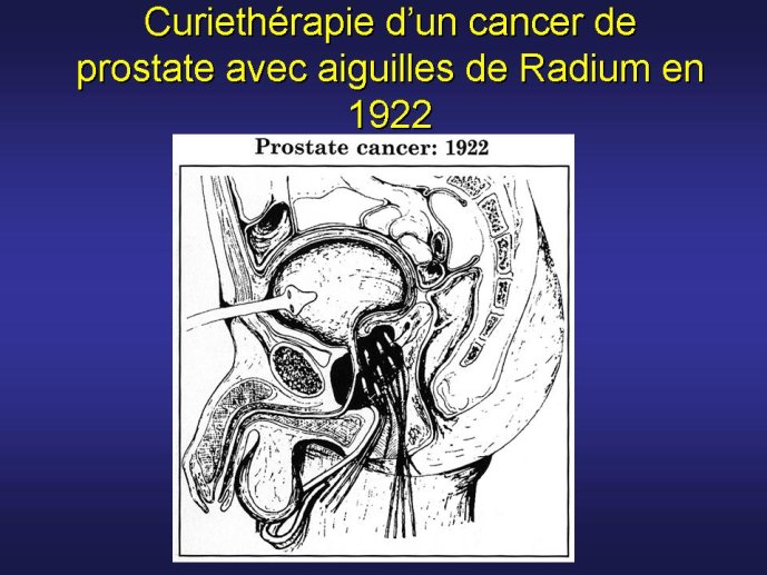 diapositive32