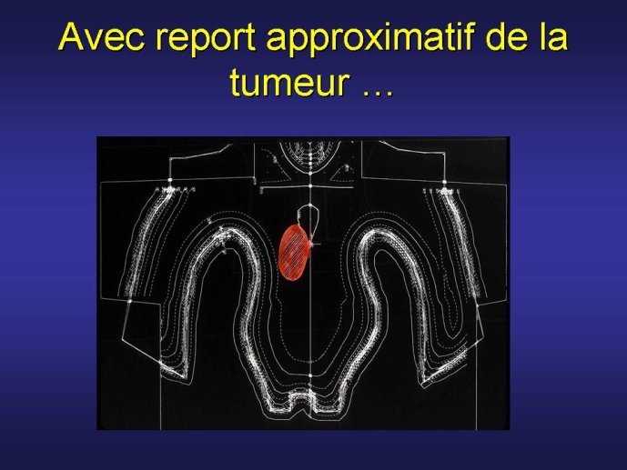 diapositive53