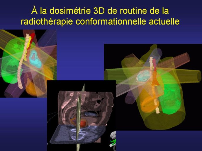 diapositive56