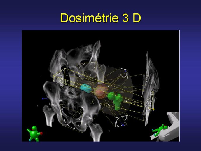diapositive57