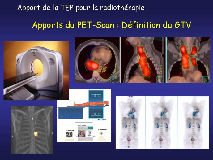 diapositive65