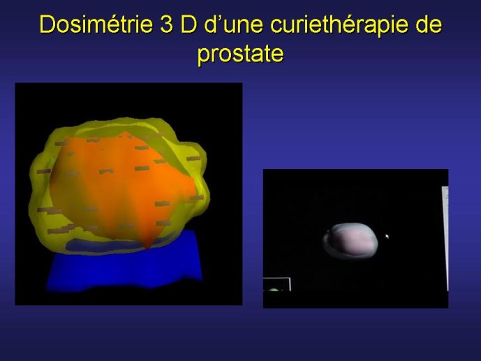 diapositive73