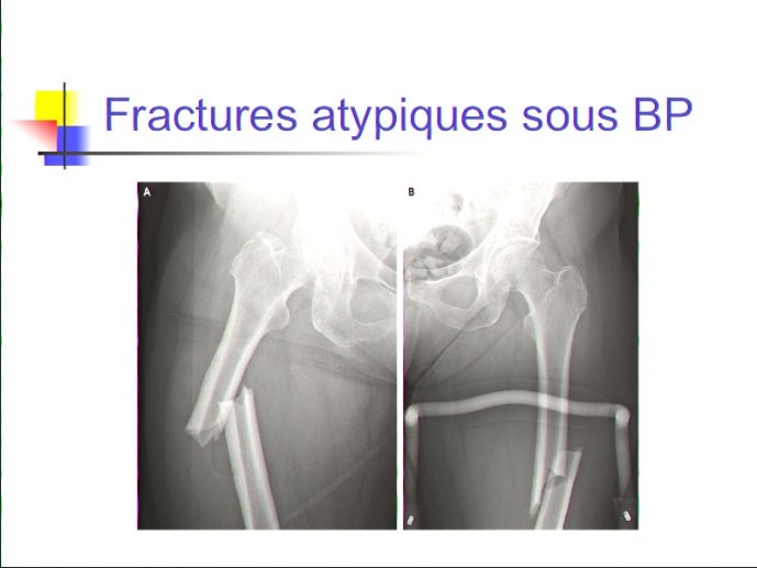 slide_0064_full
