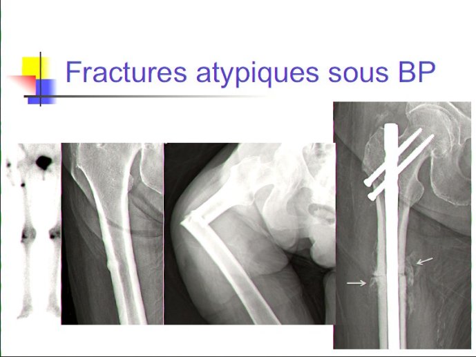 slide_0065_full