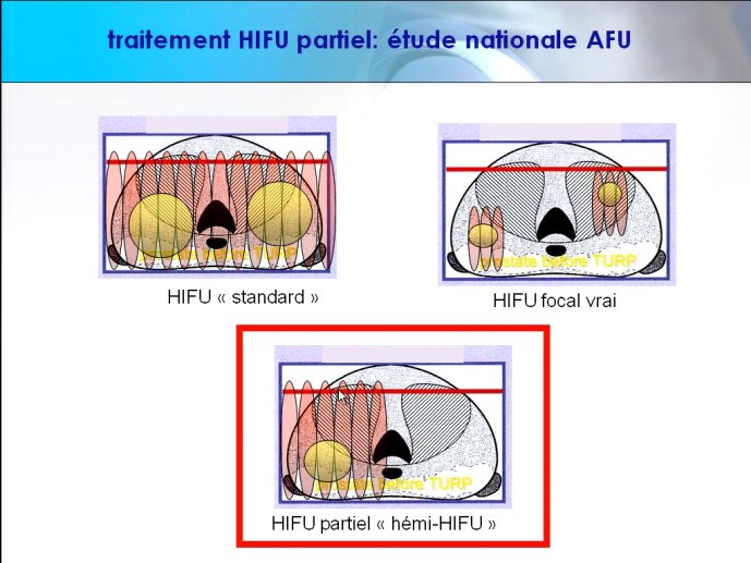 slide_0127_full