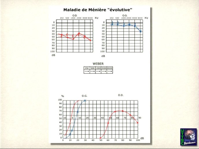 slide_0075_full
