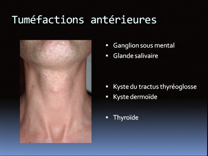 slide_0100_full