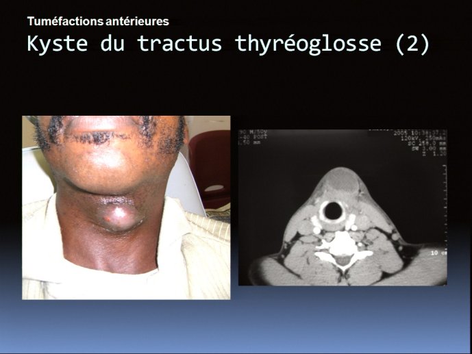 slide_0102_full