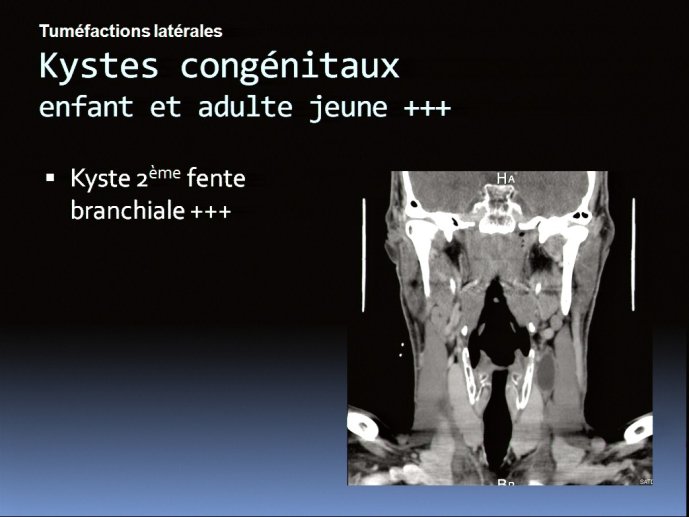 slide_0113_full