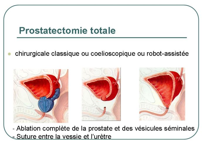 Diapositive13