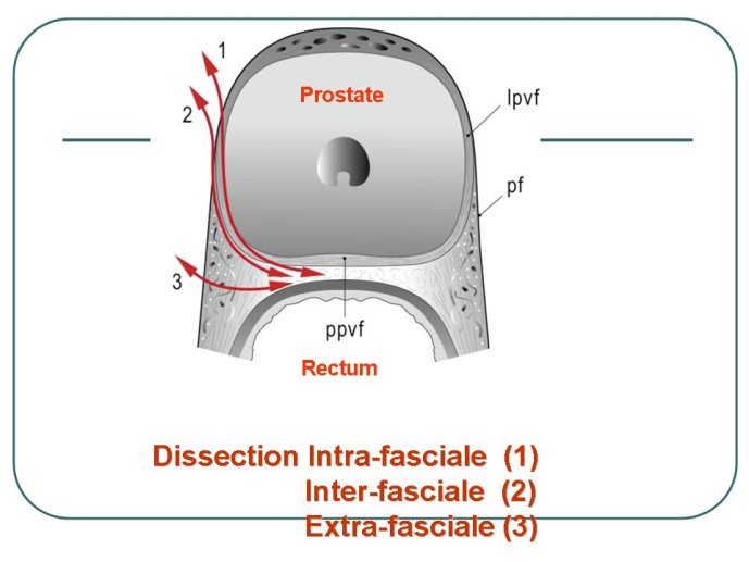 Diapositive16