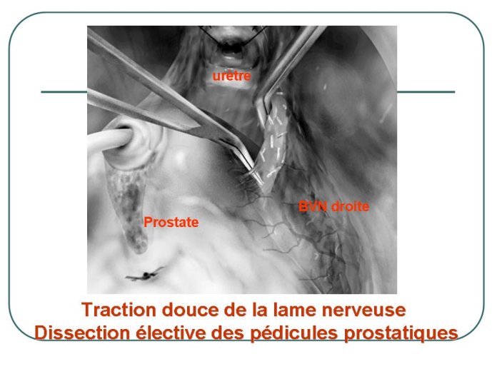 Diapositive17