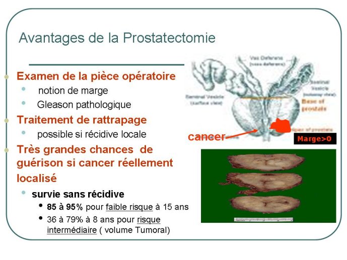 Diapositive18