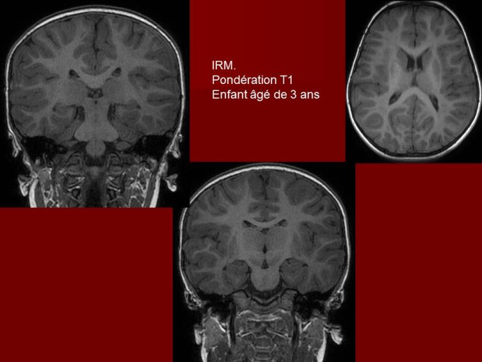 Diapositive33