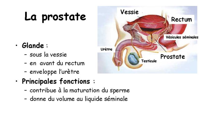 Diapositive2