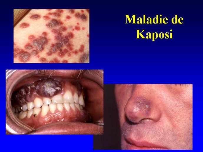 Diapositive20