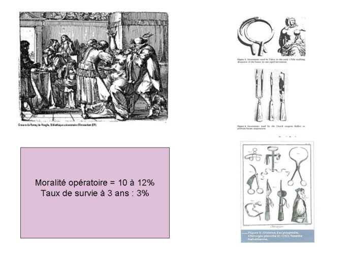 Diapositive16