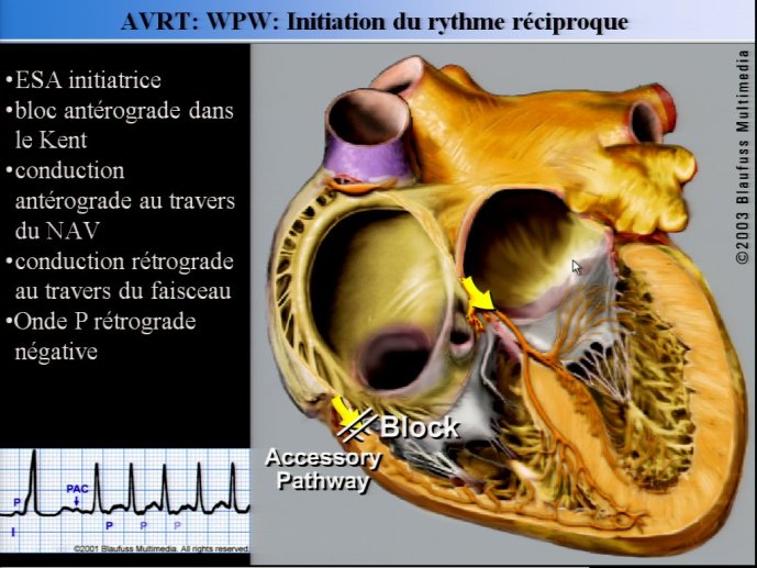 slide_0047_full