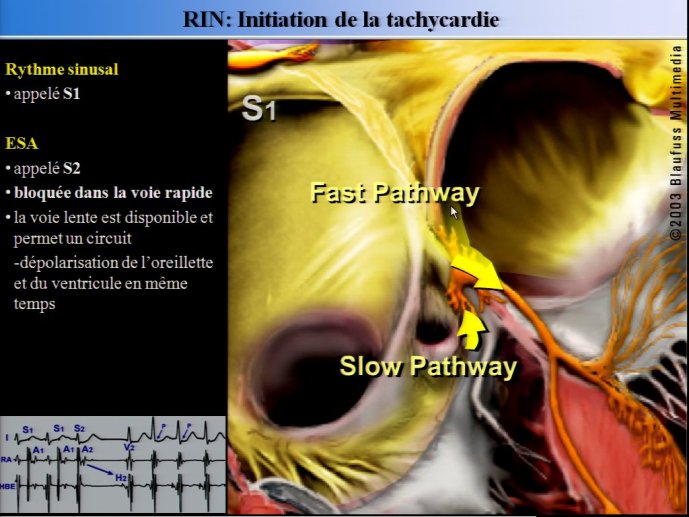 slide_0067_full